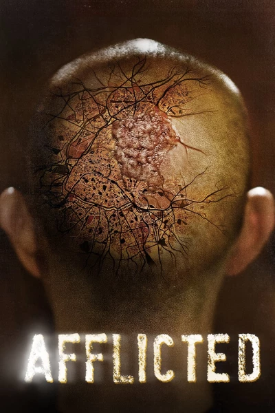 Sức Mạnh Dị Thường (Afflicted) [2014]